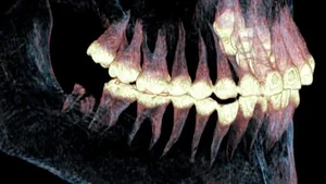 CT Scan Reveals Secrets of 2,500-Year-Old Scythian Woman Remains - image 6