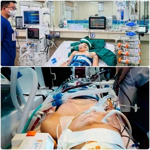 Medical Miracle: 12-Year-Old Recovers After Severe Spinal Cord Vascular Malformation - image 1