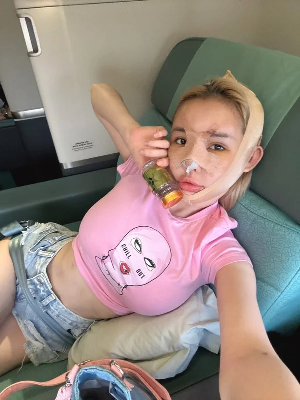 Netizens React to Ngan 98’s Striking New Look After Plastic Surgery