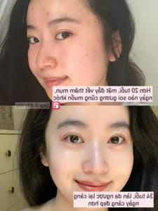 Achieving Better Skin at 34 Than at 20: 3 Life-Changing Habits Beyond Expensive Skincare - image 0