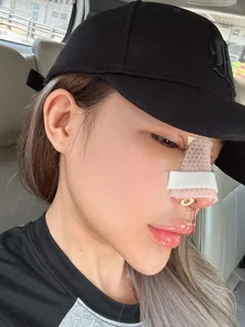 Ngan 98 Sparks Discussion After Revealing High Cost of Nose Surgery - image 4