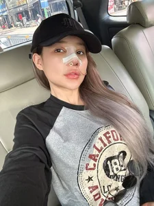 Ngan 98 Sparks Discussion After Revealing High Cost of Nose Surgery - image 5