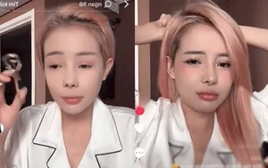 Ngan 98 Sparks Discussion After Revealing High Cost of Nose Surgery - image 6