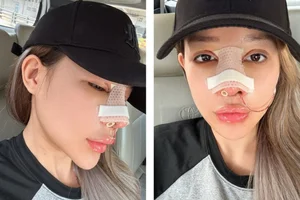Ngan 98 Sparks Discussion After Revealing High Cost of Nose Surgery - image 7