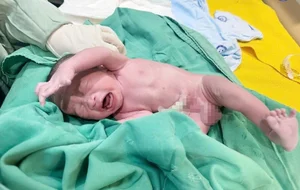 A Mother’s Battle: Fighting Cervical Cancer for the Love of Her Child - image 0