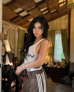 Xuan Ca Opens Up About Her Personal Plastic Surgery Journey - image 1