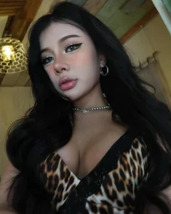 Xuan Ca Opens Up About Her Personal Plastic Surgery Journey - image 8