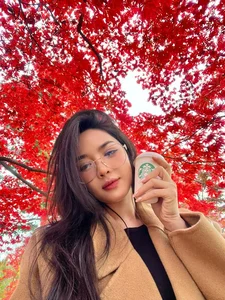 Rising Above Criticism: Nam Dinh's 'Plastic Surgery Hot Girl' Speaks Out - image 3
