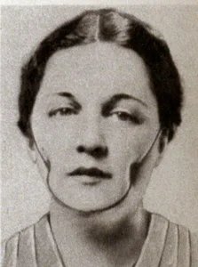Bizarre Beauty Inventions from History: How People Prettied Up - image 0