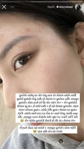 Saigon Model Experiences Strange Skin Issues After Intense Pilates Workouts - image 5