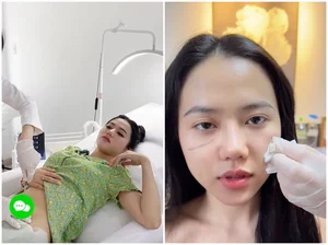 Vietnamese TikToker Bo Chanh Shares Plastic Surgery Journey - image 3