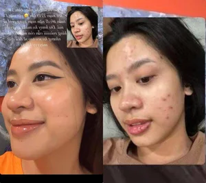 Unfiltered Truth: How Unhealthy Eating Habits Impacted This Natural Beauty's Look - image 2