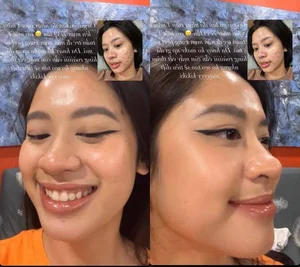 Unfiltered Truth: How Unhealthy Eating Habits Impacted This Natural Beauty's Look - image 0