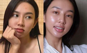 Miss Grand Thuy Tien Opens Up About Body Imperfections and Postpartum-Like Stretch Marks - image 4