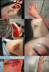 Concerns Rise Over the Management and Well-being of Jisoo from BLACKPINK - image 0
