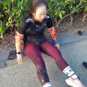 Terrifying Wildlife Encounter: Jogger Attacked by Mysterious Creature During Morning Run - image 5