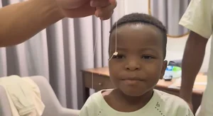 Internet Sensation Loi Con Charms Fans During First Tooth Extraction - image 0
