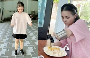 Inspirational Story of Phu Tho Mother Rebuilding Life After Losing Limbs - image 3