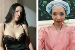 Inspiring Post-Pregnancy Plastic Surgery Transformation: Standing Confidently Beside Miss Grand Thuy Tien - image 4