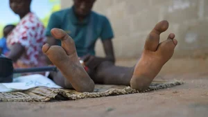 The Mystery of the Ostrich People: Understanding the Vadoma Tribe's Unique Genetic Condition - image 7