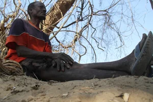 The Mystery of the Ostrich People: Understanding the Vadoma Tribe's Unique Genetic Condition - image 6