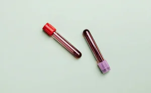 Japan Develops Universal Artificial Blood with No Refrigeration Required - image 4