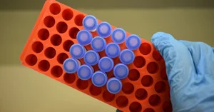 Japan Develops Universal Artificial Blood with No Refrigeration Required - image 1