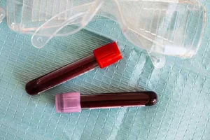 Japan Develops Universal Artificial Blood with No Refrigeration Required - image 3