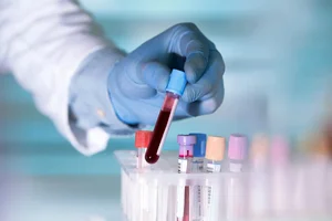 Japan Develops Universal Artificial Blood with No Refrigeration Required - image 7
