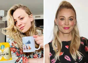 6 Hollywood Stars Who Gained Ultimate Confidence Through Cosmetic Procedures - image 3