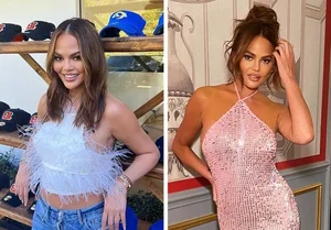 6 Hollywood Stars Who Gained Ultimate Confidence Through Cosmetic Procedures - image 0