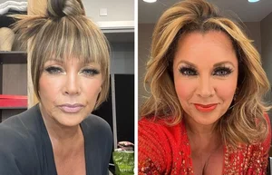 6 Hollywood Stars Who Gained Ultimate Confidence Through Cosmetic Procedures - image 4