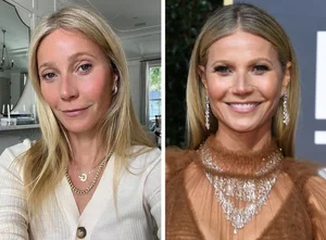 6 Hollywood Stars Who Gained Ultimate Confidence Through Cosmetic Procedures - image 5