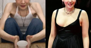 Fans Express Concern Over Popular K-Drama Actress's Extremely Thin Appearance - image 2