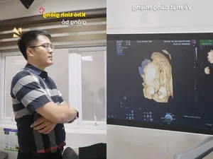 Miss Ngoc Han Shares Heartwarming Ultrasound Stories and Pregnancy Journey - image 3