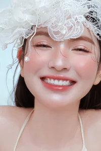 Chu Thanh Huyen Addresses Fan Concerns Over Bruises During Recent Livestream - image 0