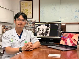 Modern Medical Breakthroughs: Treating Late-Stage Liver Cancer with New Technology - image 2