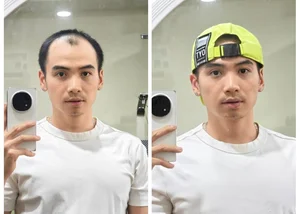 H’hen Nie’s Partner Reveals Surprising Reason for Wearing a Hat at Public Events - image 1