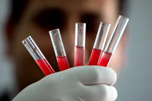 Medical Science: Understanding the Rarest Blood Types and Their Impact in Vietnam - image 3