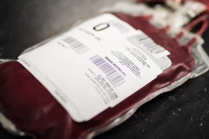 Medical Science: Understanding the Rarest Blood Types and Their Impact in Vietnam - image 5