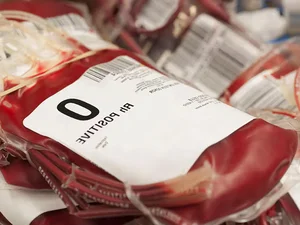 Medical Science: Understanding the Rarest Blood Types and Their Impact in Vietnam - image 6