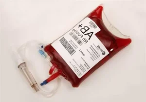 Medical Science: Understanding the Rarest Blood Types and Their Impact in Vietnam - image 2