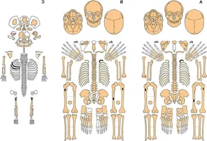 The Faces of Our Ancestors: New Stone Age Facial Reconstructions - image 7