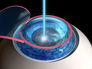 The Extraordinary Science of Lasers: Amazing Facts About Concentrated Light Technology - image 5